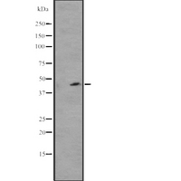 WWTR1 / TAZ Antibody - Western blot analysis of WWTR1 expression in HeLa cells lysate. The lane on the left is treated with the antigen-specific peptide.
