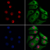 XAB2 Antibody - Staining HeLa cells by IF/ICC. The samples were fixed with PFA and permeabilized in 0.1% Triton X-100, then blocked in 10% serum for 45 min at 25°C. Samples were then incubated with primary Ab(1:200) and mouse anti-beta tubulin Ab(1:200) for 1 hour at 37°C. An AlexaFluor594 conjugated goat anti-rabbit IgG(H+L) Ab(1:200 Red) and an AlexaFluor488 conjugated goat anti-mouse IgG(H+L) Ab(1:600 Green) were used as the secondary antibod