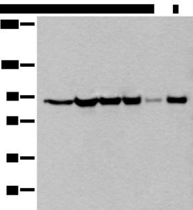 XAB2 Antibody - Western blot analysis of 293T cell lysates  using XAB2 Polyclonal Antibody at dilution of 1:250