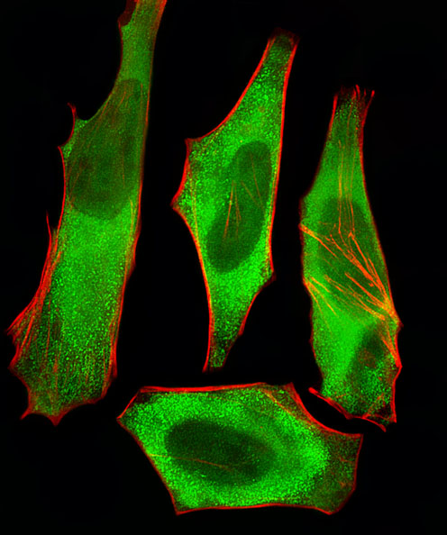 XAF1 Antibody - Fluorescent image of HeLa cells stained with XAF1 Antibody. Antibody was diluted at 1:25 dilution. An Alexa Fluor 488-conjugated goat anti-rabbit lgG at 1:400 dilution was used as the secondary antibody (green). Cytoplasmic actin was counterstained with Alexa Fluor 555 conjugated with Phalloidin (red).