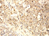 XAF1 Antibody -  This image was taken for the unconjugated form of this product. Other forms have not been tested.