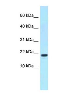 XAGE1E Antibody - XAGE1D / GAGED2 antibody Western blot of Fetal Kidney lysate. Antibody concentration 1 ug/ml.  This image was taken for the unconjugated form of this product. Other forms have not been tested.