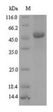 NAD-dependent deacetylase Protein - (Tris-Glycine gel) Discontinuous SDS-PAGE (reduced) with 5% enrichment gel and 15% separation gel.