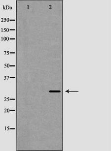 XBP1 Antibody - Western blot analysis of XBP1 expression in HepG2 cells lysate. The lane on the left is treated with the antigen-specific peptide.