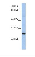 XBP1 Antibody - 721_B cell lysate. Antibody concentration: 1.0 ug/ml. Gel concentration: 12%.  This image was taken for the unconjugated form of this product. Other forms have not been tested.