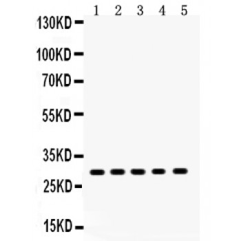 XBP1 Antibody - XBP antibody Western blot. All lanes: Anti XBP1 at 0.5 ug/ml. Lane 1: MCF-7 Whole Cell Lysate at 40 ug. Lane 2: MM231 Whole Cell Lysate at 40 ug. Lane 3: MM453 Whole Cell Lysate at 40 ug. Lane 4: SKOV Whole Cell Lysate at 40 ug. Lane 5: HELA Whole Cell Lysate at 40 ug. Predicted band size: 29 kD. Observed band size: 29 kD.