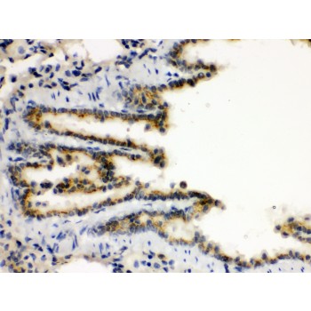 XBP1 Antibody - XBP antibody IHC-paraffin. IHC(P): Rat Lung Tissue.