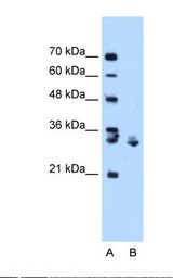 XBP1 Antibody - Lane A: Marker. Lane B: Jurkat cell lysate. Antibody concentration: 1.0 ug/ml. Gel concentration: 12%.  This image was taken for the unconjugated form of this product. Other forms have not been tested.