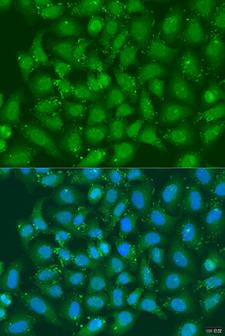 XBP1 Antibody - Immunofluorescence analysis of U2OS cells using XBP1 antibodyat dilution of 1:100. Blue: DAPI for nuclear staining.