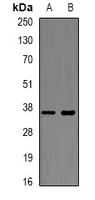 XBP1 Antibody - Western blot analysis of XBP1 expression in HT29 (A); Jurkat (B) whole cell lysates.