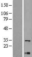 XBP1 Protein - Western validation with an anti-DDK antibody * L: Control HEK293 lysate R: Over-expression lysate
