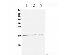 XCL1 / Lymphotactin Antibody - Western blot analysis of Lymphotactin using anti-Lymphotactin antibody
