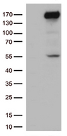 XDH / Xanthine Oxidase Antibody - HEK293T cells were transfected with the pCMV6-ENTRY control. (Left lane) or pCMV6-ENTRY XDH. (Right lane) cDNA for 48 hrs and lysed. Equivalent amounts of cell lysates. (5 ug per lane) were separated by SDS-PAGE and immunoblotted with anti-XDH. (1:500)