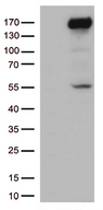 XDH / Xanthine Oxidase Antibody - HEK293T cells were transfected with the pCMV6-ENTRY control. (Left lane) or pCMV6-ENTRY XDH. (Right lane) cDNA for 48 hrs and lysed