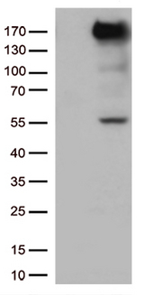 XDH / Xanthine Oxidase Antibody - HEK293T cells were transfected with the pCMV6-ENTRY control. (Left lane) or pCMV6-ENTRY XDH. (Right lane) cDNA for 48 hrs and lysed. Equivalent amounts of cell lysates. (5 ug per lane) were separated by SDS-PAGE and immunoblotted with anti-XDH. (1:500)