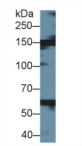 XDH / Xanthine Oxidase Antibody - Western Blot; Sample: Bovine Liver lysate; Primary Ab: 1µg/ml Rabbit Anti-Bovine XDH Antibody Second Ab: 0.2µg/mL HRP-Linked Caprine Anti-Rabbit IgG Polyclonal Antibody