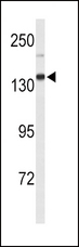 XDH / Xanthine Oxidase Antibody - Western blot of XDH Antibody in mouse lung tissue lysates (35 ug/lane). XDH (arrow) was detected using the purified antibody.