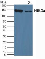 XDH / Xanthine Oxidase Antibody - Western Blot; Sample: Lane1: Mouse Liver Tissue; Lane2: Mouse Lung Tissue.