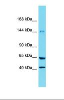 XDH / Xanthine Oxidase Antibody - Western blot of Rat Lung. Xdh antibody dilution 1.0 ug/ml.  This image was taken for the unconjugated form of this product. Other forms have not been tested.
