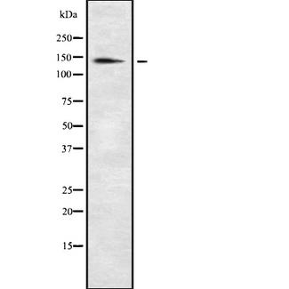 XDH / Xanthine Oxidase Antibody - Western blot analysis of XDH using HepG2 whole cells lysates