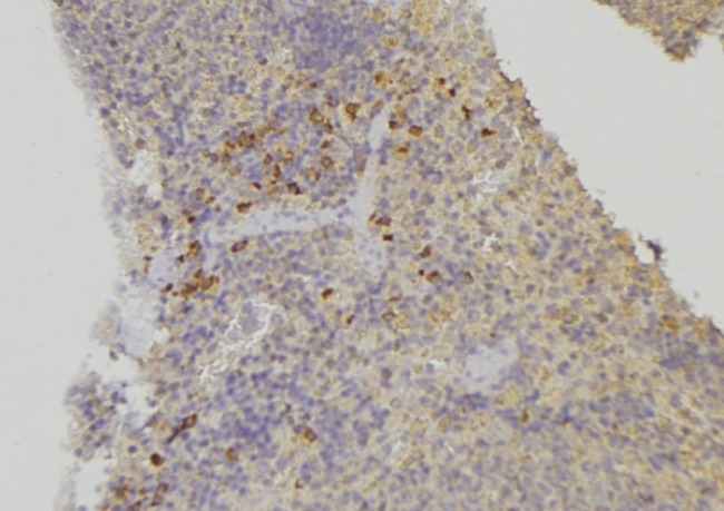 XDH / Xanthine Oxidase Antibody - 1:100 staining human lymph node tissue by IHC-P. The sample was formaldehyde fixed and a heat mediated antigen retrieval step in citrate buffer was performed. The sample was then blocked and incubated with the antibody for 1.5 hours at 22°C. An HRP conjugated goat anti-rabbit antibody was used as the secondary.