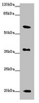 XG Antibody - Western blot All lanes: XG antibody at 10µg/ml + Mouse heart tissue Secondary Goat polyclonal to rabbit IgG at 1/10000 dilution Predicted band size: 20, 22 kDa Observed band size: 20, 37, 60 kDa