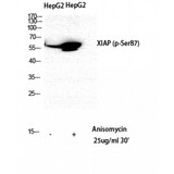 XIAP Antibody - Western blot of Phospho-XIAP (S87) antibody