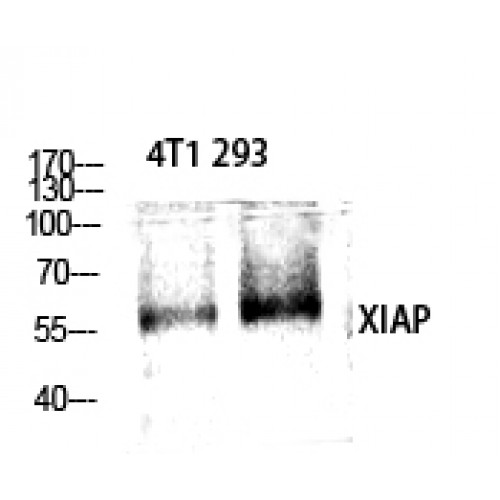 XIAP Antibody - Western blot of XIAP antibody