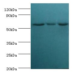 XIAP Antibody - Western blot. All lanes: XIAP antibody at 3 ug/ml. Lane 1: HepG2 whole cell lysate. Lane 2: MCF-7 whole cell lysate. Lane 3: PC-3 whole cell lysate. Secondary antibody: Goat polyclonal to rabbit at 1:10000 dilution. Predicted band size: 57 kDa. Observed band size: 57 kDa.