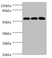 XIAP Antibody - Western blot All lanes: XIAP antibody at 3µg/ml Lane 1: HepG2 whole cell lysate Lane 2: MCF-7 whole cell lysate Lane 3: PC-3 whole cell lysate Secondary Goat polyclonal to rabbit IgG at 1/10000 dilution Predicted band size: 57 kDa Observed band size: 57 kDa