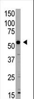 XIAP Antibody - The anti-BIRC4 antibody is used in Western blot to detect BIRC4 in mouse liver tissue lysate.