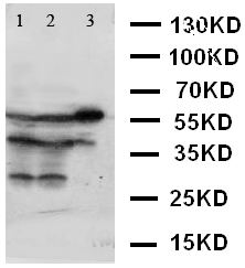 XIAP Antibody - WB of XIAP antibody. Lane 1: SMMC Cell Lysate. Lane 2: HELA Cell Lysate. Lane 3: A431 Cell Lysate.