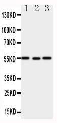 XIAP Antibody - Anti-XIAP antibody, Western blotting All lanes: Anti XIAP at 0.5ug/ml Lane 1: SMMC Whole Cell Lysate at 40ug Lane 2: HELA Whole Cell Lysate at 40ug Lane 3: A431 Whole Cell Lysate at 40ug Predicted bind size: 55KD Observed bind size: 55KD