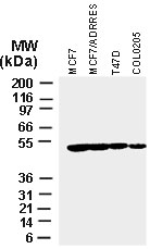 XIAP Antibody - Western blot of XIAP in various tumor cell lines recombinant Polyclonal Antibody to XIAP at 1:2000.