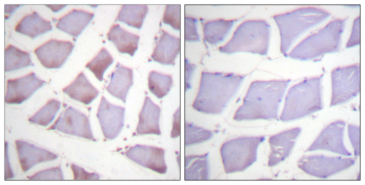 XIAP Antibody - Immunohistochemistry analysis of paraffin-embedded human skeletal muscle tissue, using XIAP Antibody. The picture on the right is blocked with the synthesized peptide.