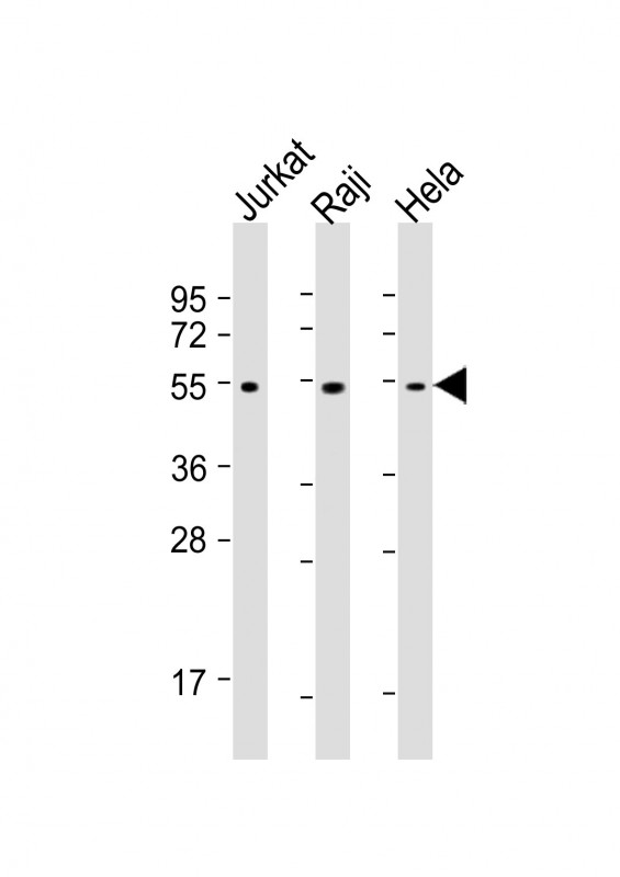 XIAP Antibody - All lanes: Anti-XIAP Antibody at 1:1000-1:4000 dilution. Lane 1: Jurkat whole cell lysates. Lane 2: Raji whole cell lysates. Lane 3: HeLa whole cell lysates Lysates/proteins at 20 ug per lane. Secondary Goat Anti-mouse IgG, (H+L), Peroxidase conjugated at 1:10000 dilution. Predicted band size: 57 kDa. Blocking/Dilution buffer: 5% NFDM/TBST.