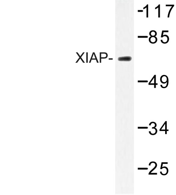 XIAP Antibody - Western blot of XIAP (G81) pAb in extracts from 293 cells.
