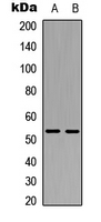 XIAP Antibody - Western blot analysis of XIAP expression in HeLa (A); HEK293T (B) whole cell lysates.