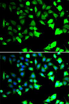 XIAP Antibody - Immunofluorescence analysis of HeLa cell using XIAP antibody. Blue: DAPI for nuclear staining.