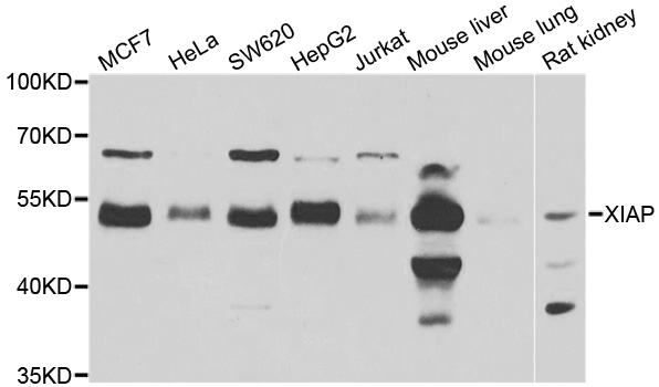 XIAP Antibody - Western blot analysis of extracts of various cell lines.