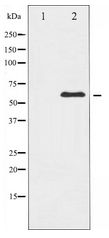 XIAP Antibody - Western blot of XIAP expression in 293 whole cell lysates,The lane on the left is treated with the antigen-specific peptide.