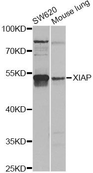 XIAP Antibody - Western blot analysis of extracts of various cell lines, using XIAP antibody at 1:1000 dilution. The secondary antibody used was an HRP Goat Anti-Rabbit IgG (H+L) at 1:10000 dilution. Lysates were loaded 25ug per lane and 3% nonfat dry milk in TBST was used for blocking. An ECL Kit was used for detection and the exposure time was 10s.
