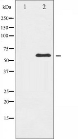 XIAP Antibody - Western blot analysis of XIAP expression in 293 whole cells lysates. The lane on the left is treated with the antigen-specific peptide.