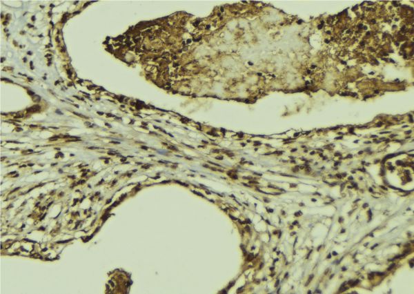 XIAP Antibody - 1:100 staining mouse colon tissue by IHC-P. The sample was formaldehyde fixed and a heat mediated antigen retrieval step in citrate buffer was performed. The sample was then blocked and incubated with the antibody for 1.5 hours at 22°C. An HRP conjugated goat anti-rabbit antibody was used as the secondary.