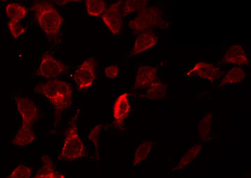 XIAP Antibody - Staining HepG2 cells by IF/ICC. The samples were fixed with PFA and permeabilized in 0.1% Triton X-100, then blocked in 10% serum for 45 min at 25°C. The primary antibody was diluted at 1:200 and incubated with the sample for 1 hour at 37°C. An Alexa Fluor 594 conjugated goat anti-rabbit IgG (H+L) Ab, diluted at 1/600, was used as the secondary antibody.