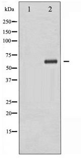 XIAP Antibody - Western blot of XIAP phosphorylation expression in Anisomycin treated HepG2 whole cell lysates,The lane on the left is treated with the antigen-specific peptide.