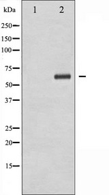 XIAP Antibody - Western blot analysis of XIAP phosphorylation expression in Anisomycin treated HepG2 whole cells lysates. The lane on the left is treated with the antigen-specific peptide.