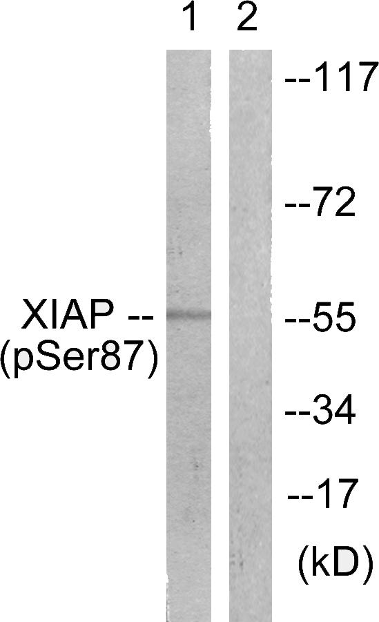 XIAP Antibody - Western blot analysis of extracts from HepG2 cells, treated with Anisomycin (25ug/ml, 30mins), using XIAP (Phospho-Ser87) antibody.