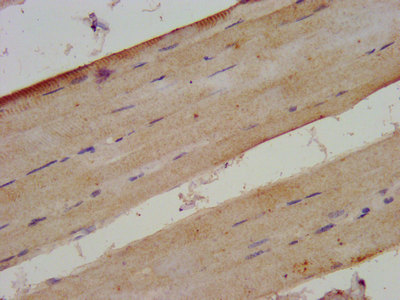 XIRP2 Antibody - Immunohistochemistry image at a dilution of 1:300 and staining in paraffin-embedded human skeletal muscle tissue performed on a Leica BondTM system. After dewaxing and hydration, antigen retrieval was mediated by high pressure in a citrate buffer (pH 6.0) . Section was blocked with 10% normal goat serum 30min at RT. Then primary antibody (1% BSA) was incubated at 4 °C overnight. The primary is detected by a biotinylated secondary antibody and visualized using an HRP conjugated SP system.