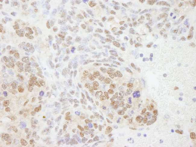 XPA Antibody - Detection of Mouse XPA by Immunohistochemistry. Sample: FFPE section of mouse teratoma. Antibody: Affinity purified rabbit anti-XPA used at a dilution of 1:100.